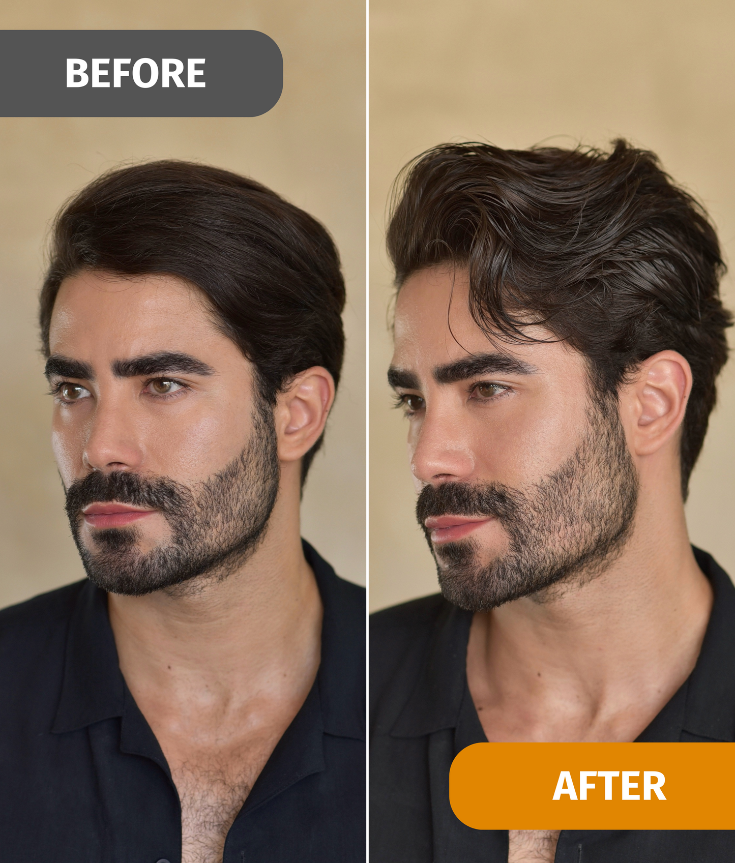 The Beach Kit - Black Friday Exclusive